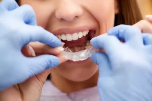 Invisalign Teen (Gençler İçin)